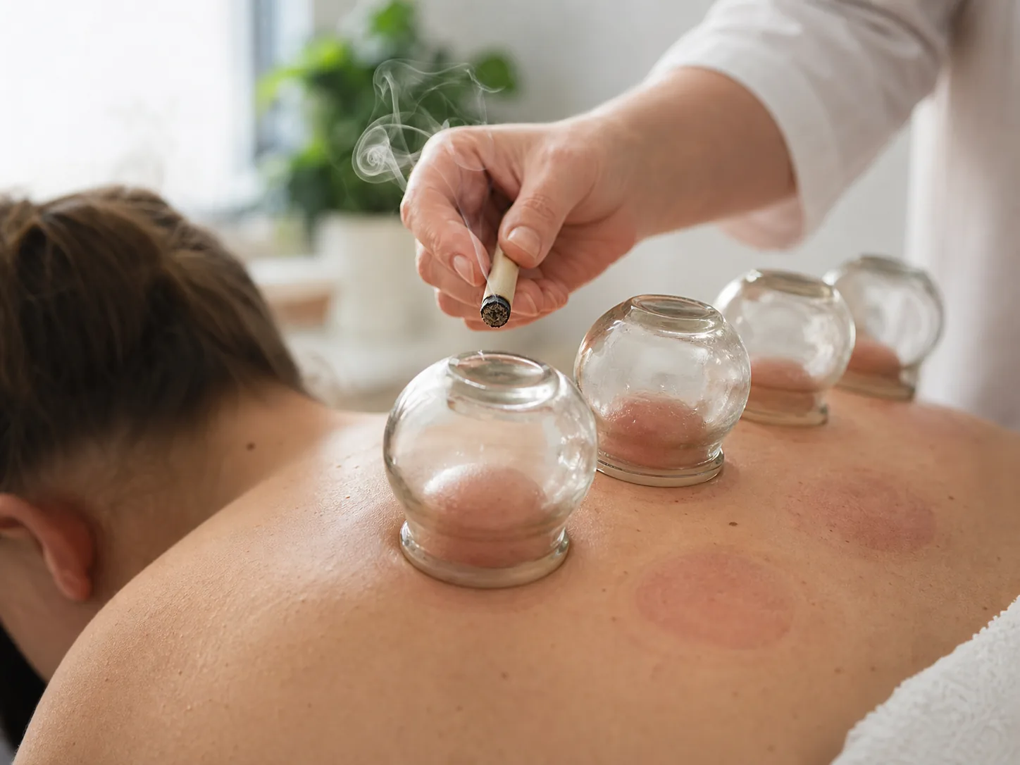 Cupping & moxibustion