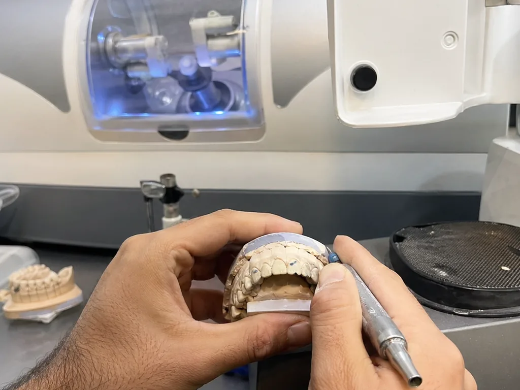 Clear Aligner Course