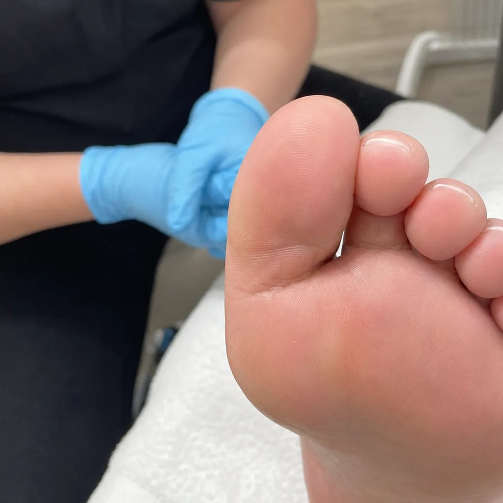Foot Care — Foot Care (vue 4)
