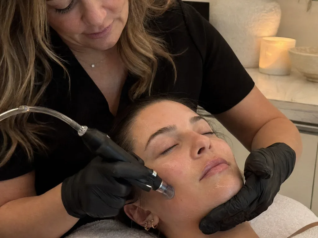 Hyaluronic acid filler