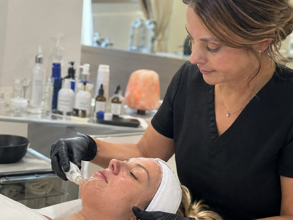 Microneedling RF